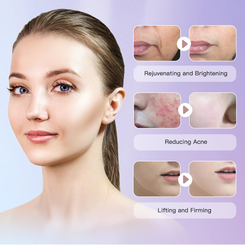 HIFU 3in1 Facial Machine: Wrinkle Removal, Ultrasound RF EMS, Skin Rejuvenation, AntiAging(white)