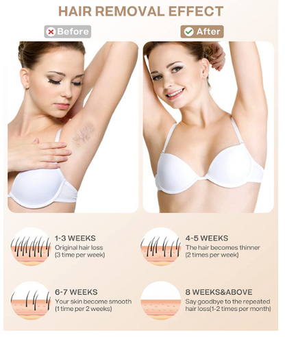 IPL Hair Removal Device with Ice Cooling, Unlimited Flashes, 6 Energy Levels – At-Home Laser Hair Removal for Women and Men