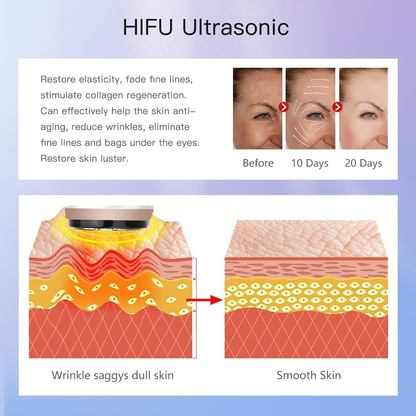 HIFU 3in1 Facial Machine: Wrinkle Removal, Ultrasound RF EMS, Skin Rejuvenation, AntiAging(white)
